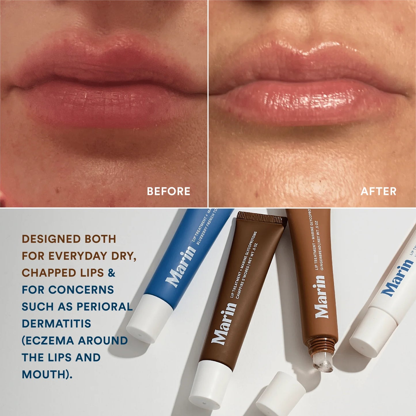 Marin | Lip Treatment
