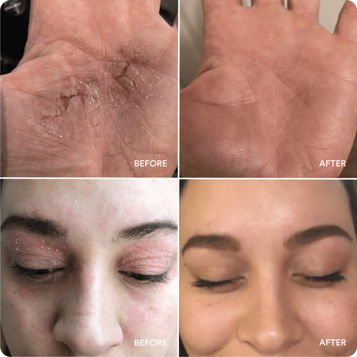 Marin | Soothing Hydration Cream
